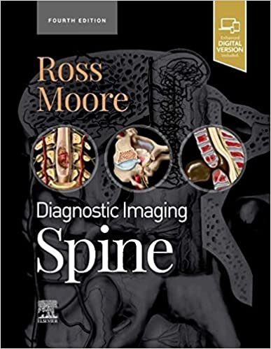 Diagnostic Imaging Spine