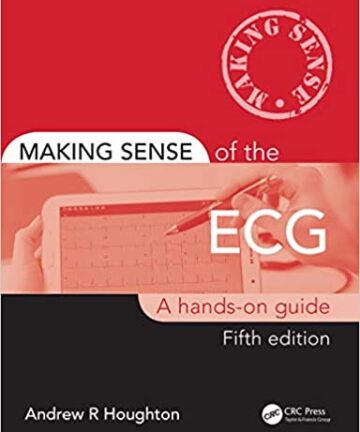 Making Sense of the ECG: A Hands-On Guide (original pdf)