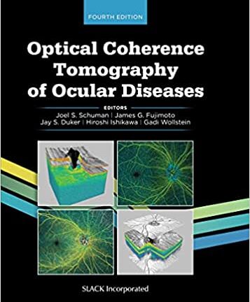 Optical Coherence Tomography of Ocular Diseases (original pdf)