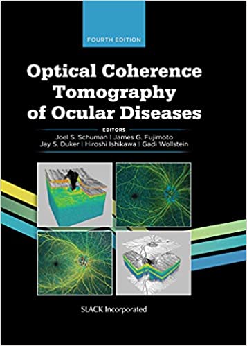 Optical Coherence Tomography of Ocular Diseases (original pdf)