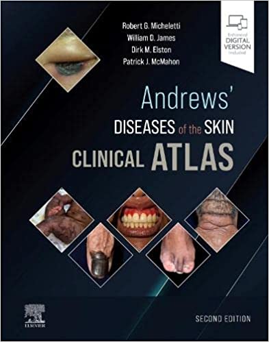 Andrews' Diseases of the Skin Clinical Atlas (original pdf)