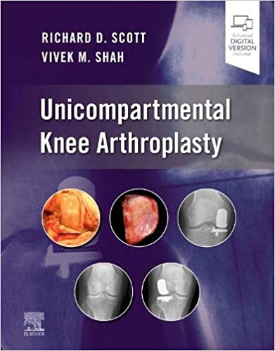 Unicompartmental Knee Arthroplasty (original pdf)