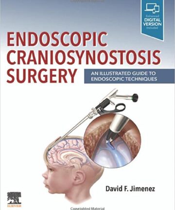 Endoscopic Craniosynostosis Surgery: An Illustrated Guide to Endoscopic Techniques (original pdf)