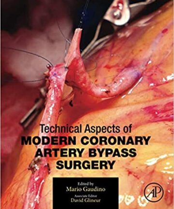Technical Aspects of Modern Coronary Artery Bypass Surgery (original pdf)