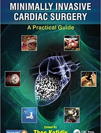 Minimally Invasive Cardiac Surgery: A Practical Guide (original pdf)